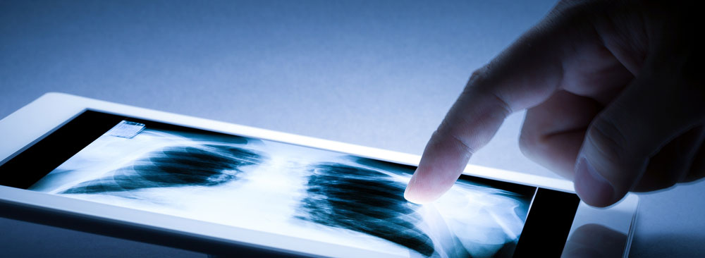 Healthcare IT Frustrations: Too Many Devices Trying To Access Your WLAN